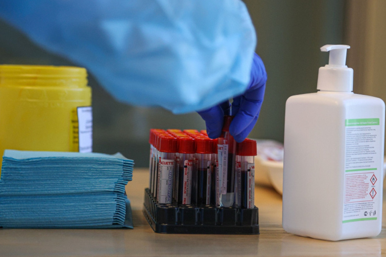 Врач раскрыла, как избежать заражения сифилисом или вовремя его выявить