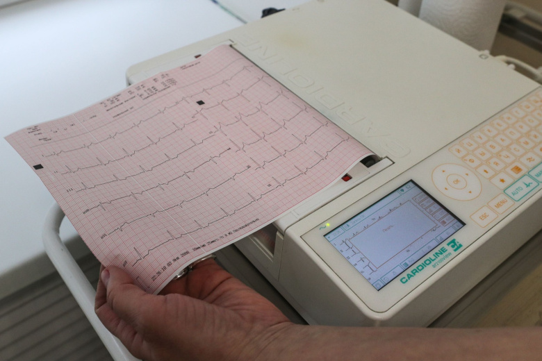 Кардиолог рассказал о различиях между типами инсультов